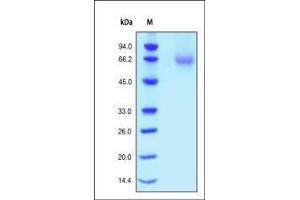 Human FGF R1, His Tag on SDS-PAGE under reducing (R) condition. (FGFR1 Protein (AA 22-376) (His tag))