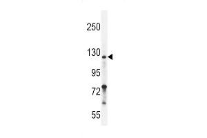 Western blot analysis in ZR-75-1 cell line lysates (35ug/lane). (NRP2 antibody  (C-Term))