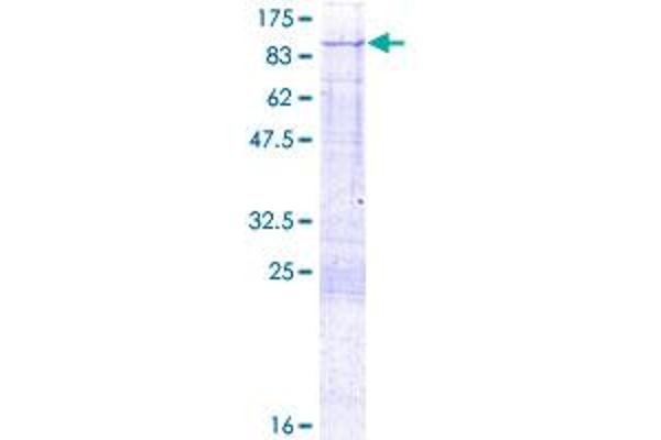 PFKL Protein (AA 1-827) (GST tag)