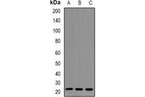 Western blot analysis of RhoC expression in Jurkat (A), A549 (B), PC12 (C) whole cell lysates. (RHOC antibody)