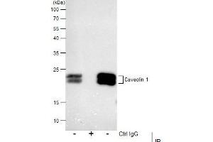 IP Image Immunoprecipitation of Caveolin 1 protein from A549 membrane extracts using 5 μg of Caveolin 1 antibody [N1N3], Western blot analysis was performed using Caveolin 1 antibody [N1N3], EasyBlot anti-Rabbit IgG  was used as a secondary reagent. (Caveolin-1 antibody  (N-Term))