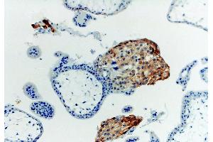 Immunohistochemistry (Paraffin-embedded Sections) (IHC (p)) image for anti-HLA Class I Histocompatibility Antigen, alpha Chain G (HLAG) antibody (ABIN94366)