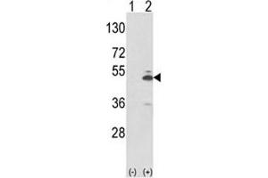 Western blot analysis of PKM2 antibody and 293 cell lysate (2 ug/lane) either nontransfected (Lane 1) or transiently transfected with the PKM2 gene (2). (PKM2 antibody  (AA 116-145))