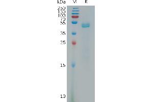 Human PDGFD(19-370) Protein, His Tag on SDS-PAGE under reducing condition. (PDGFD Protein (AA 19-370) (His tag))