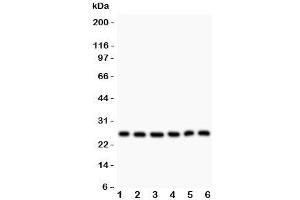 Western blot testing of Galectin 3 antibody and Lane 1:  HeLa;  2: SGC;  3: MCF-7;  4: SW620;  5: A375;  6: SMMC-7721 lysate. (Galectin 3 antibody  (AA 139-250))