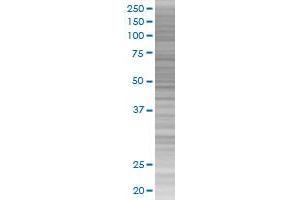 RARB transfected lysate. (RARB 293T Cell Transient Overexpression Lysate(Denatured))