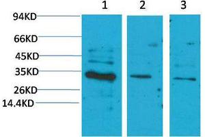 Western Blot (WB) analysis of 1) HeLa, 2)Mouse Brain Tissue, 3)Rat Brain Tissue with CNTF Rabbit Polyclonal Antibody diluted at 1:2000. (CNTF antibody)