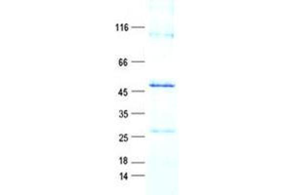 RTP4 Protein (GST tag,His tag)