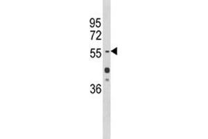 Western blot analysis of HNF1A antibody and mouse liver tissue lysate. (HNF1A antibody  (AA 177-205))