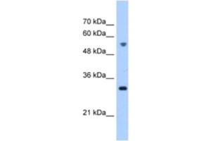 Western Blotting (WB) image for anti-Tetratricopeptide Repeat Domain 5 (TTC5) antibody (ABIN2463249) (TTC5 antibody)