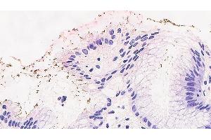 Immunohistochemical staining for Helicobacter pylori: clone ULC3R (Helicobacter Pylori antibody)