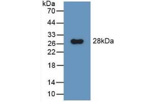 Western blot analysis of recombinant Rat GluAP. (ENPEP antibody  (AA 409-624))