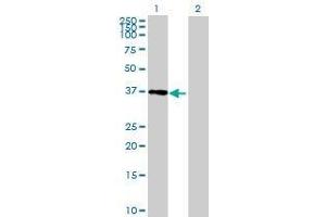 Lane 1: DNAJB7 transfected lysate ( 35. (DNAJB7 293T Cell Transient Overexpression Lysate(Denatured))