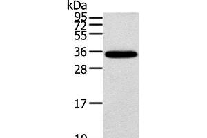 Western Blot analysis of Mouse brain tissue using KCNMB3 Polyclonal Antibody at dilution of 1:300 (KCNMB3 antibody)