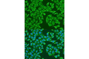 Immunofluorescence analysis of U2OS cells using IGF2BP3 antibody (ABIN6293021) at dilution of 1:100. (IGF2BP3 antibody)