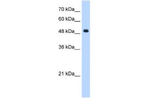 Septin 6 antibody used at 1. (Septin 6 antibody  (Middle Region))