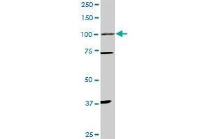 Western Blotting (WB) image for anti-Progesterone Receptor (PGR) (AA 1-111) antibody (ABIN598869) (Progesterone Receptor antibody  (AA 1-111))