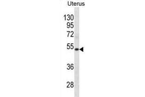 KRT72 Antibody (Center) (ABIN1881487 and ABIN2838797) western blot analysis in human Uterus tissue lysates (35 μg/lane). (Keratin 72 antibody  (AA 313-342))
