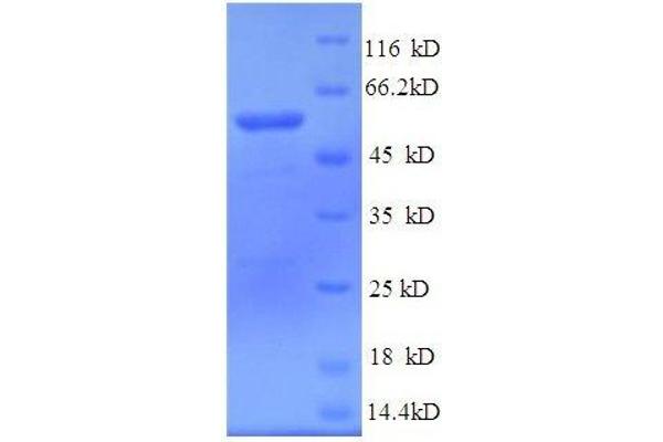 TUBB3 Protein (AA 1-210, partial) (GST tag)