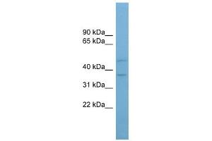 AADACL4 antibody used at 1 ug/ml to detect target protein. (AADACL4 antibody  (Middle Region))