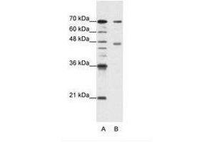 PABPC4抗体（AA 181-230）