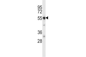 Western Blotting (WB) image for anti-Solute Carrier Family 11 (Proton-Coupled Divalent Metal Ion Transporters), Member 2 (SLC11A2) antibody (ABIN2997547) (SLC11A2 antibody)