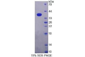 SDS-PAGE analysis of Human NAPa Protein. (NAPA Protein)