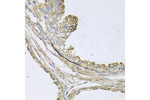 Immunohistochemistry of paraffin-embedded human prostate using ApoE antibody at dilution of 1:100 (x40 lens). (APOE antibody)