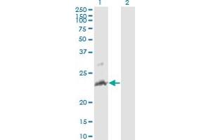 Western Blot analysis of TNFSF14 expression in transfected 293T cell line by TNFSF14 monoclonal antibody (M01), clone 4E3. (TNFSF14 antibody  (AA 61-170))