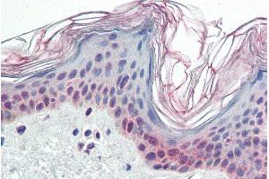 ABIN185561 (5µg/ml) staining of paraffin embedded Human Skin. (PARP2 antibody  (Internal Region))