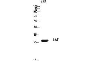 Western Blot (WB) analysis of 293 using LAT antibody. (LAT antibody)