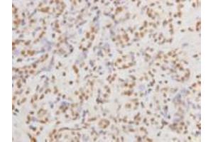 Immunohistochemistry (Paraffin-embedded Sections) (IHC (p)) image for anti-Protein Kinase, DNA-Activated, Catalytic Polypeptide (PRKDC) (Catalytic Subunit) antibody (ABIN1112714) (PRKDC antibody  (Catalytic Subunit))