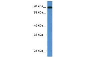 Image no. 1 for anti-Lysyl Oxidase-Like 2 (LOXL2) (AA 607-656) antibody (ABIN6746389) (LOXL2 antibody  (AA 607-656))