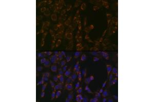 Immunofluorescence analysis of NIH-3T3 cells using CLPP Rabbit mAb (ABIN1682296, ABIN3017596, ABIN3017597 and ABIN7101508) at dilution of 1:100 (40x lens). (CLPP antibody)