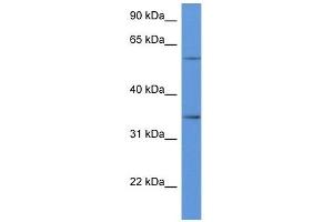 Western Blot showing CD34 antibody used at a concentration of 1 ug/ml against Hela Cell Lysate (CD34 antibody  (C-Term))