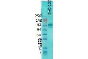 western rat membrane 1 in 1000 PSD 95. (DLG4 antibody)
