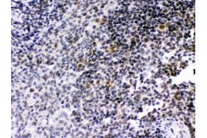 Anti- RAG2 Picoband antibody, IHC(P) IHC(P): Rat Spleen Tissue (RAG2 antibody  (C-Term))