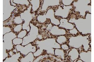 ABIN6269403 at 1/100 staining Rat lung tissue by IHC-P. (DARPP32 antibody)