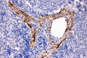 Anti-ADAM19 antibody, IHC(P) IHC(P): Rat Spleen Tissue (ADAM19 antibody  (N-Term))