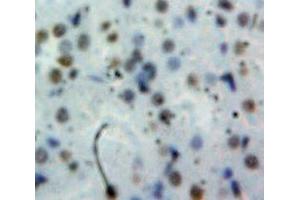 Used in DAB staining on fromalin fixed paraffin-embedded Kidney tissue (Cyclin D1 antibody  (AA 31-295))