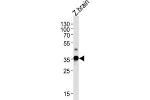 Western Blotting (WB) image for anti-Guanine Nucleotide Binding Protein (G Protein), beta Polypeptide 1 (GNB1) antibody (ABIN3004745) (GNB1 antibody)