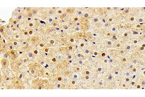 Detection of FGF2 in Rabbit Liver Tissue using Polyclonal Antibody to Fibroblast Growth Factor 2, Basic (FGF2) (FGF2 antibody  (AA 26-153))