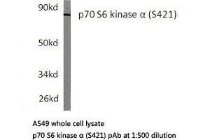 Western blot (WB) analyzes of p70 S6K antibody in extracts from A549 cells. (RPS6KB1 antibody)