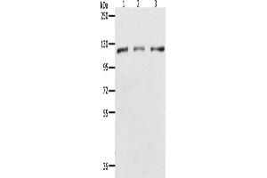 Western Blotting (WB) image for anti-Poly (ADP-Ribose) Polymerase 1 (PARP1) antibody (ABIN2432194) (PARP1 antibody)