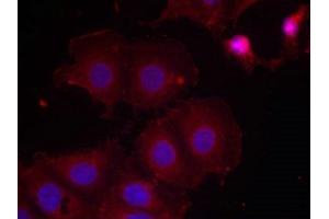 Immunofluorescence staining of methanol-fixed MCF7 cells using HER2(Phospho-Tyr877) Antibody. (ErbB2/Her2 antibody  (pTyr877))