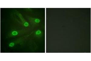 Immunofluorescence (IF) image for anti-Tumor Protein P53 (TP53) (acLys386) antibody (ABIN2890735) (p53 antibody  (acLys386))