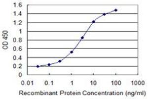Detection limit for recombinant GST tagged ZNF192 is 0. (ZNF192 antibody  (AA 1-90))