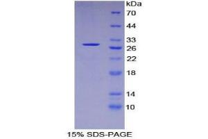 SDS-PAGE (SDS) image for Forkhead Box O1 (FOXO1) (AA 333-557) protein (His tag) (ABIN2124861) (FOXO1 Protein (AA 333-557) (His tag))