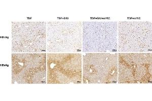 HBcAg- and HBsAg-expressing hepatocytes in individual mouse livers were stained with DAB (HBsAg with ABIN285516). (HBSAg antibody)