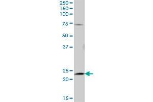 AK5 MaxPab polyclonal antibody. (Adenylate Kinase 5 antibody  (AA 1-536))